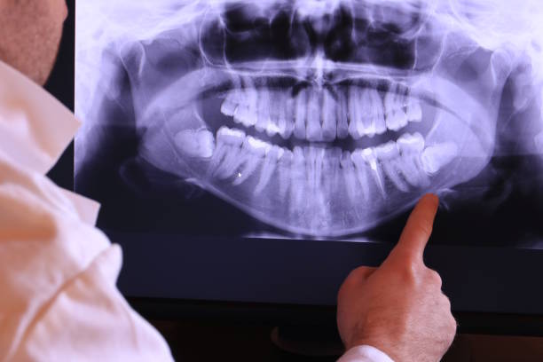 Best Pediatric Emergency Dentist in Galesville, MD